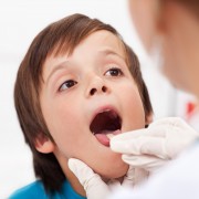 What causes a white tongue and is there a remedy for it?